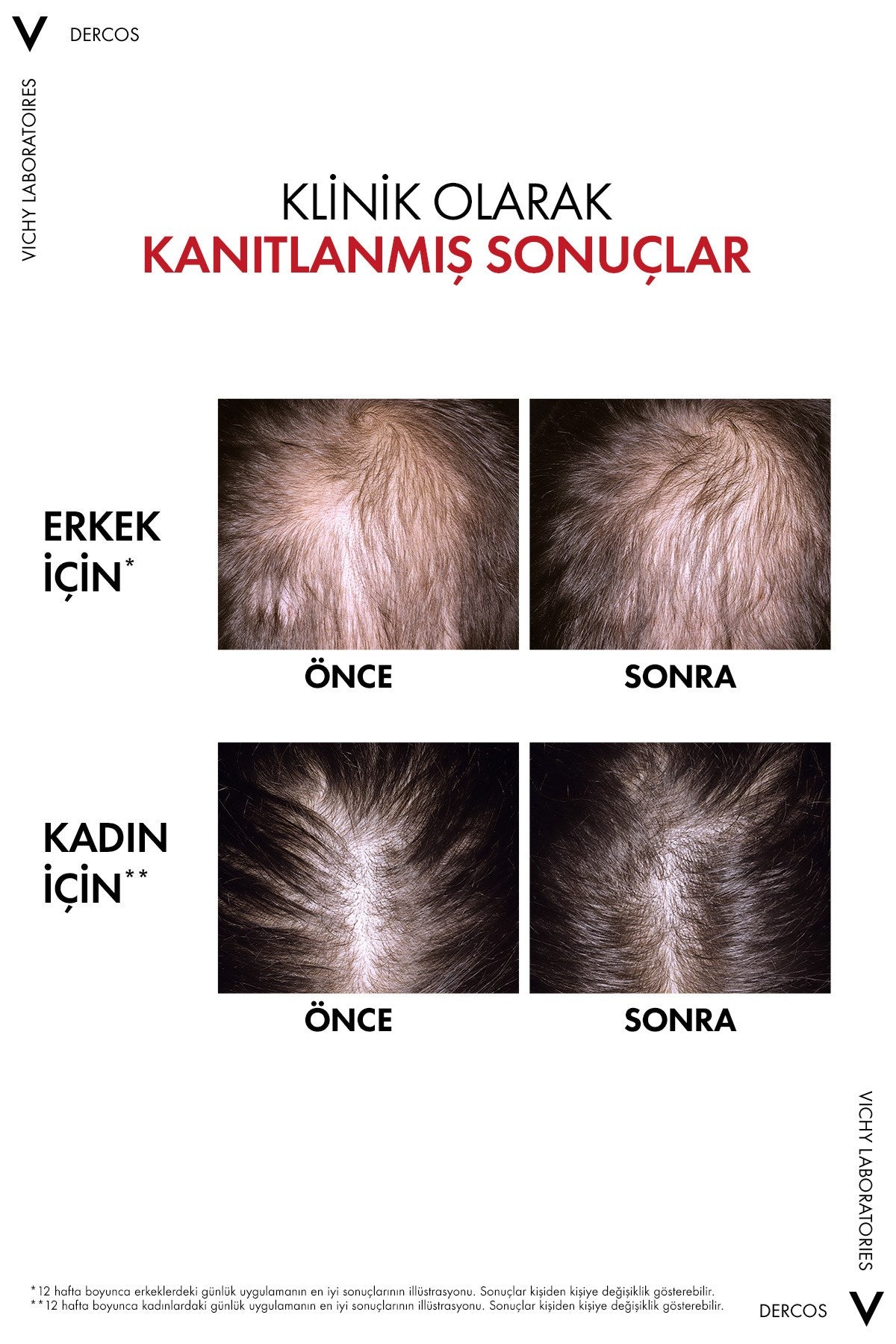 Vichy Dercos Aminexil R.E.G.E.N Booster Saç Dökülmesine Karşı Serum 90 ml